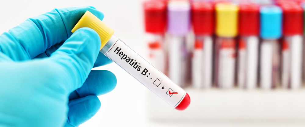 Wat ass Hepatitis B? Wat sinn dSymptomer a Behandlungsmethoden?